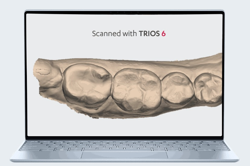 TRIOS 6