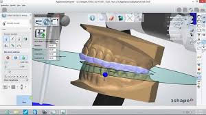 3shape Trios Software 3shape Trios Software